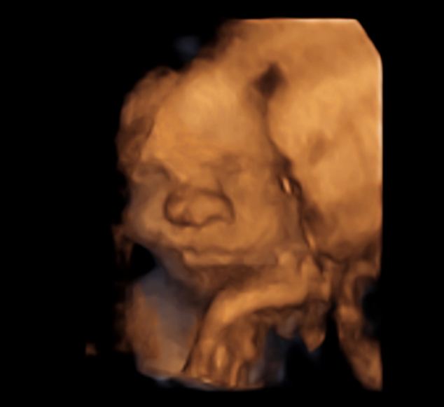 英準媽媽借3D影像&ldquo;窺探&rdquo;腹中子【圖】